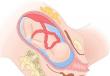 Symtom på fostrets navelsträngsförveckling