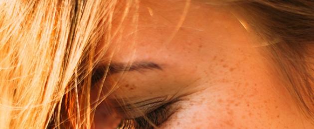Solexponering gör att huden åldras många gånger snabbare (chockerande fotofaktum).  Sol och hudens åldrande: vad säger hudläkare?  Solens skadliga effekter på huden